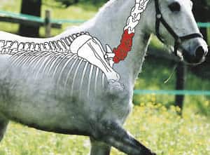 CAV Halswirbelsäule