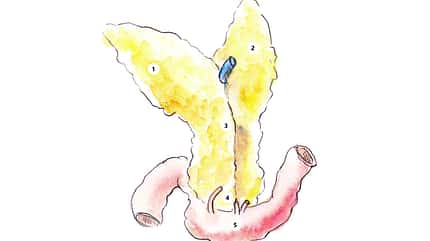 CAVALLO Kompendium Pankreatitis Kompendium Pankreatitis