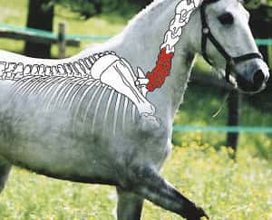 CAV Halswirbelsäule