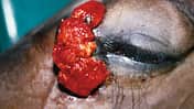 CAV Symptom-Lexikon - Equines Sarkoid