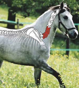 CAV Halswirbelsäule